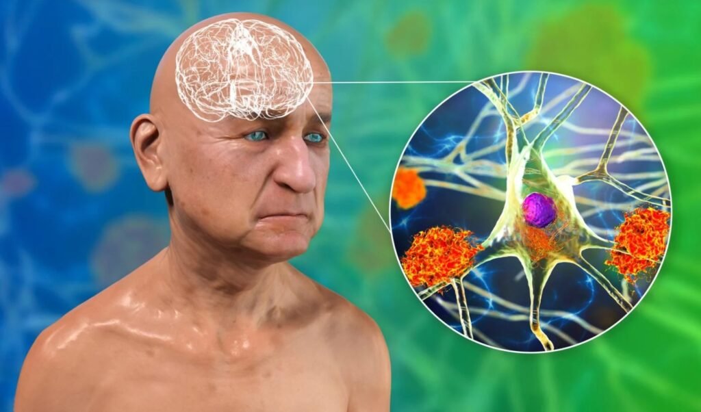 Decades of Alzheimer's